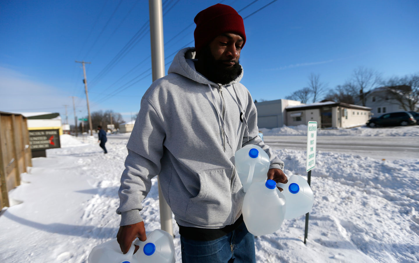 In Flint Michigan Overpriced Water Is Causing Peoples Skin To Erupt