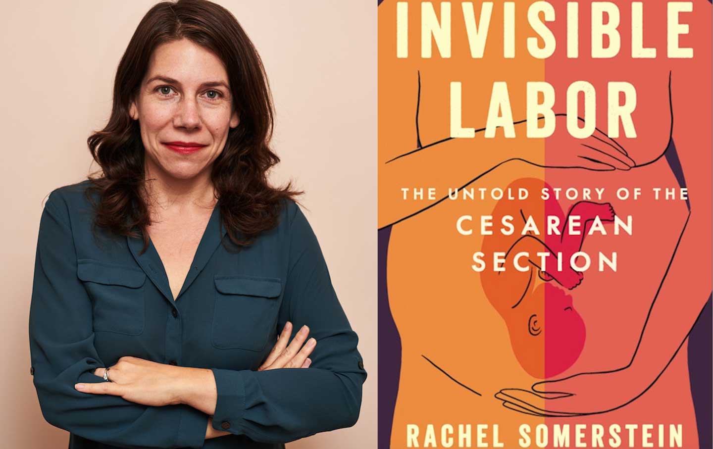 “It’s Not About the Operation. It’s About Us”: Rachel Somerstein on the Untold Story of C-Sections