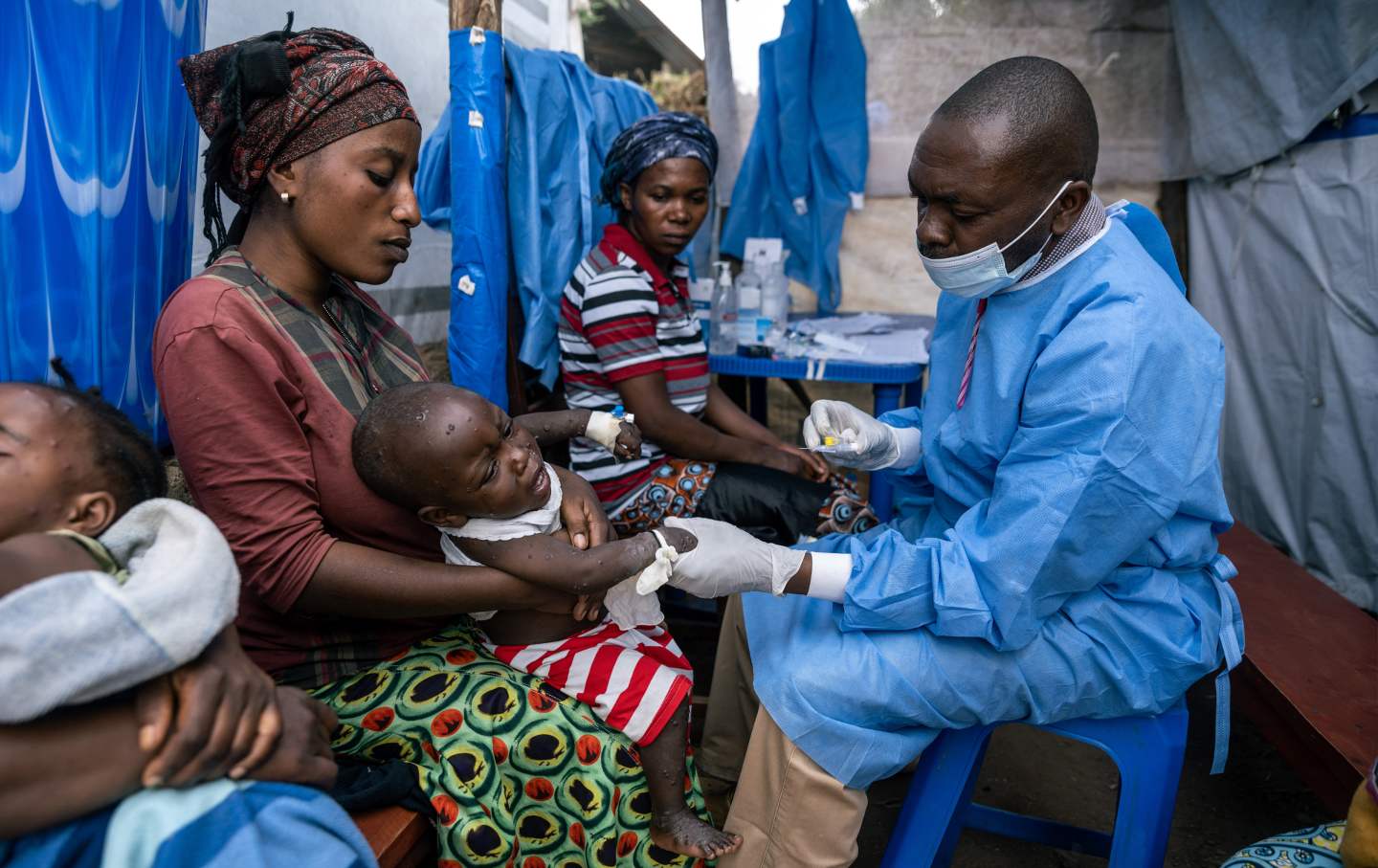 Eine Mutter hält ihren Sohn, während er seine tägliche Injektion erhält, während er im Gesundheitszentrum Kavumu im Territorium Kabare, Region Süd-Kivu, Demokratische Republik Kongo, am Dienstag, 3. September 2024, gegen MPOX behandelt wird.